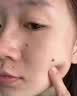 高坂制药点痣膏点斑祛疣药水脸部去黑痣扁平跖疣修复液无痕不留疤非药5ml 实拍图