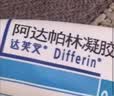 达芙文【原研好药】阿达帕林凝胶0.1%*30g/盒第三代维a酸医用祛痘印痘坑去粉刺丘疹闭口和脓疱等痤疮用药 实拍图