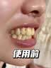韩方五谷美白牙膏十大知名品牌儿童成人去黄去烟渍除口臭清新口气抑菌 实拍图