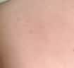 安敏优（ARMIYO）青蒿修红棒2.0次抛精华液轻享装舒缓敏感屏障改善泛红15支 实拍图