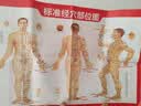 金泰康砭石艾灸罐 中医同款火龙罐双层防烫随身灸艾灸馆专用刮痧 实拍图