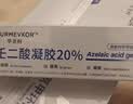 华美科 HURMEVKOR壬二酸凝胶20%医壬二酸凝胶祛痘凝露淡化痘印痘坑去水杨酸1支 实拍图