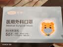 可孚口罩医用外科灭菌级防过敏口罩鼻炎防尘50只医用独立包装 实拍图