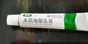 【香港制造】奥络夫西地酸乳膏2%*10g/盒 澳美制药 实拍图