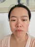 沃朗森医用面膜械字号冷敷贴医美术后补水修复祛痘印消炎透明质酸钠3盒 实拍图