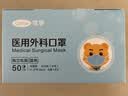 可孚口罩医用外科灭菌级防过敏口罩鼻炎防尘50只医用独立包装 实拍图