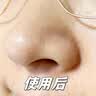 Losoki进口清洁泥膜深层清洁去黑头收缩毛孔粉刺闭口补水祛痘面膜150g 实拍图