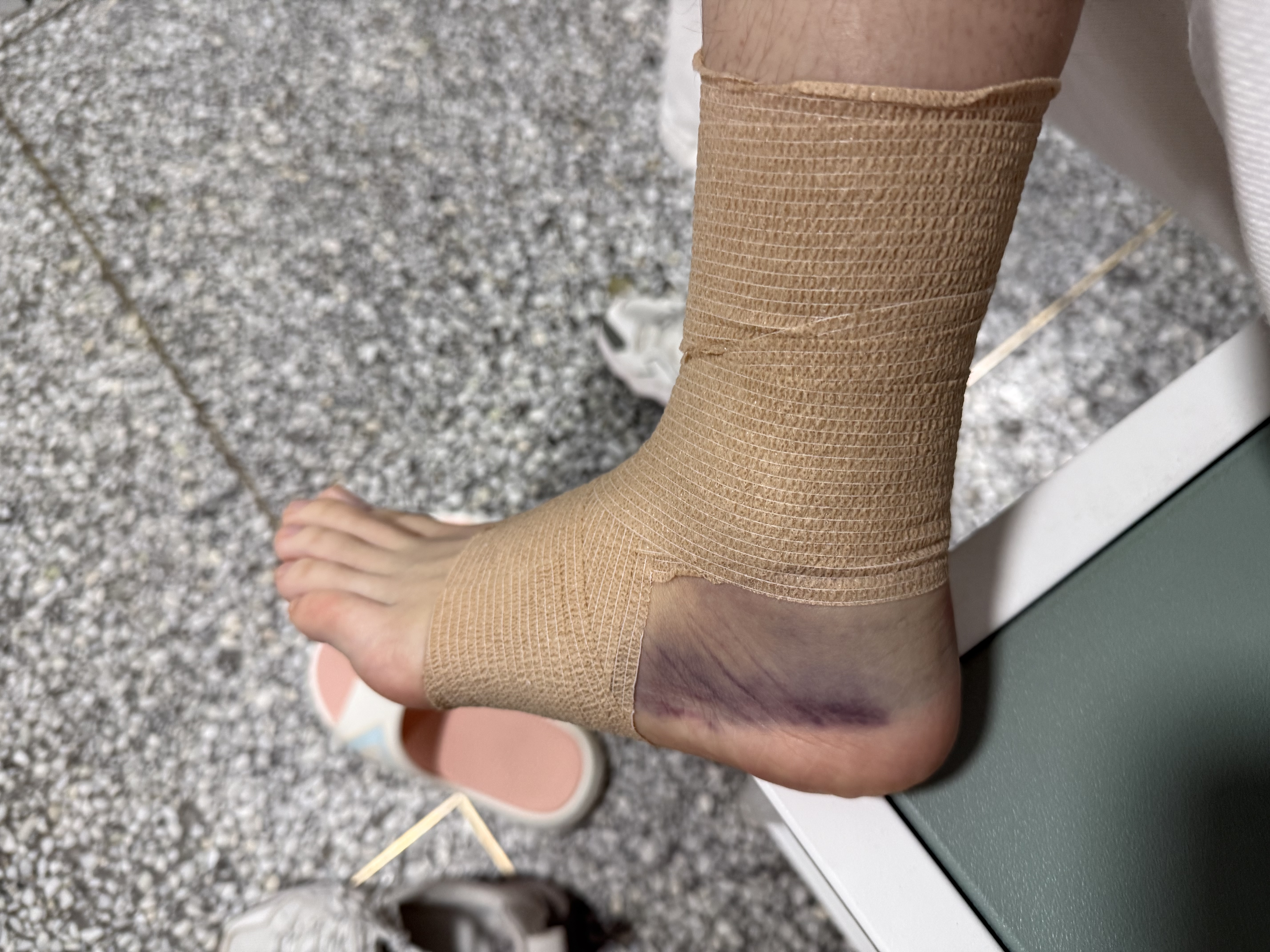 海氏海诺医用弹性绷带 自粘弹力运动绷带 手指固定纱布卷5*450cm*2卷 实拍图