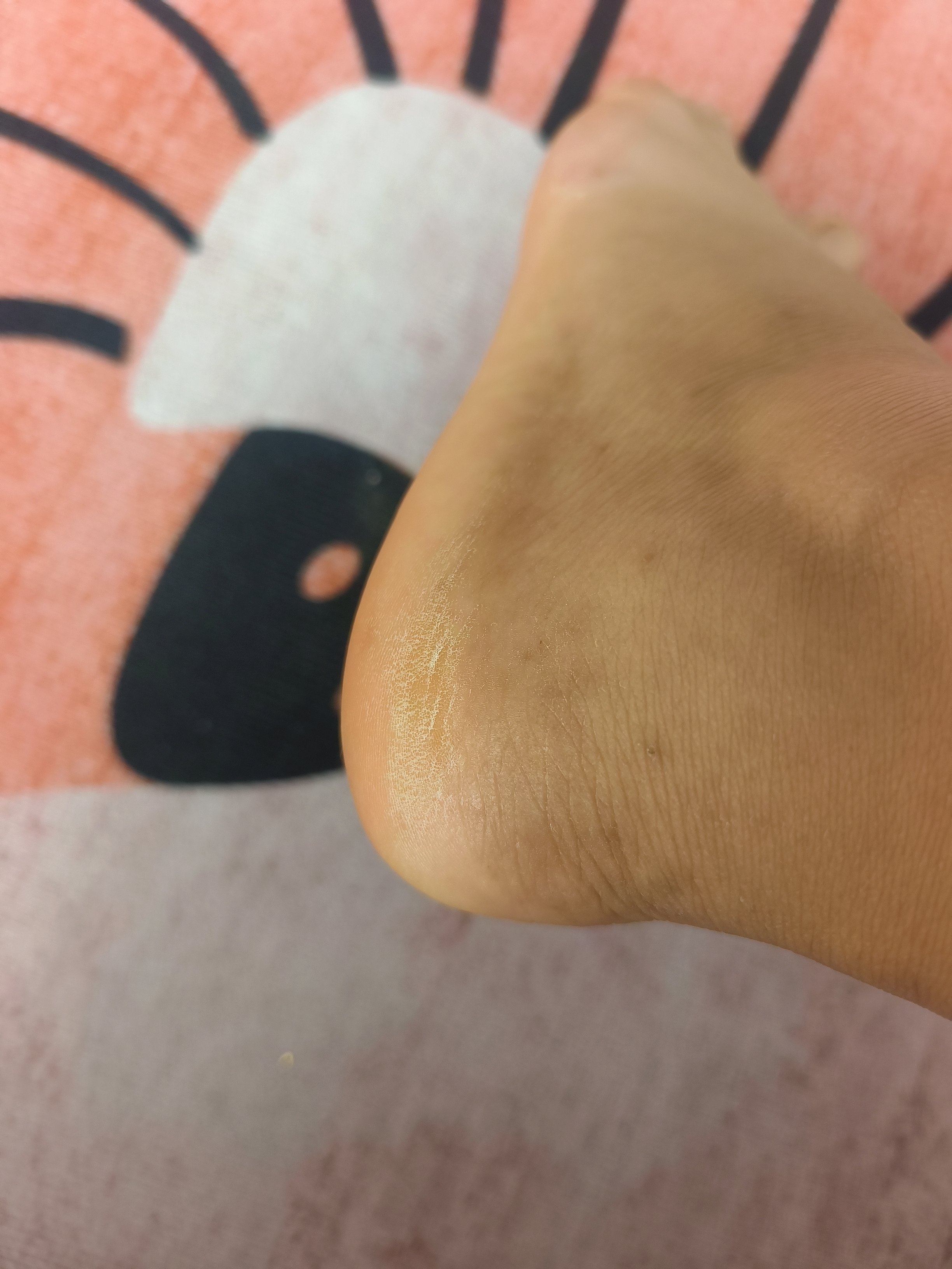 KOOGIS凡士林干裂贴脚后跟干裂贴手指干裂贴防水防裂手足开裂保护贴胶布 实拍图