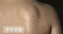 井次制药脂肪瘤专用去除神器脂肪康消除硬块脂肪粒去除皮脂腺囊肿非药膏 实拍图