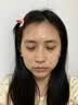 羽藤制药日本进口成分医美用烟酰胺凝胶祛斑美白淡化黑色素脸部军训专用3 实拍图