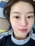华美科医用修复皮肤屏障受损泛红修护乳液全能面霜补水保湿械字号1支 实拍图