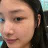 羽藤制药日本进口成分医美用烟酰胺凝胶祛斑美白淡化黑色素脸部军训专用3 实拍图