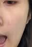 Newliann医用重组三型人源化胶原蛋白修护凝胶表皮祛疤痕修复敷料生长因子 实拍图