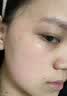 华美科医用修复皮肤屏障保湿面霜女士械字号敏感肌受损泛红修护补水1瓶 实拍图