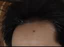 蔓迪【独家获批】蔓迪二代米诺地尔5%生发泡沫剂60g*3男女专用治脱发防脱洗发水育发米洛酊搽剂 实拍图