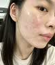 华美科湿敷水修复皮肤屏障受损修护爽肤补水保湿收缩毛孔精华液1瓶 实拍图