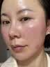 Newliann医用重组三型人源化胶原蛋白修护凝胶表皮修复敷料生长因子护理膜 实拍图