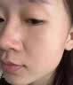 高坂制药点痣膏点斑祛疣药水脸部去黑痣扁平跖疣修复液无痕不留疤非药5ml 实拍图