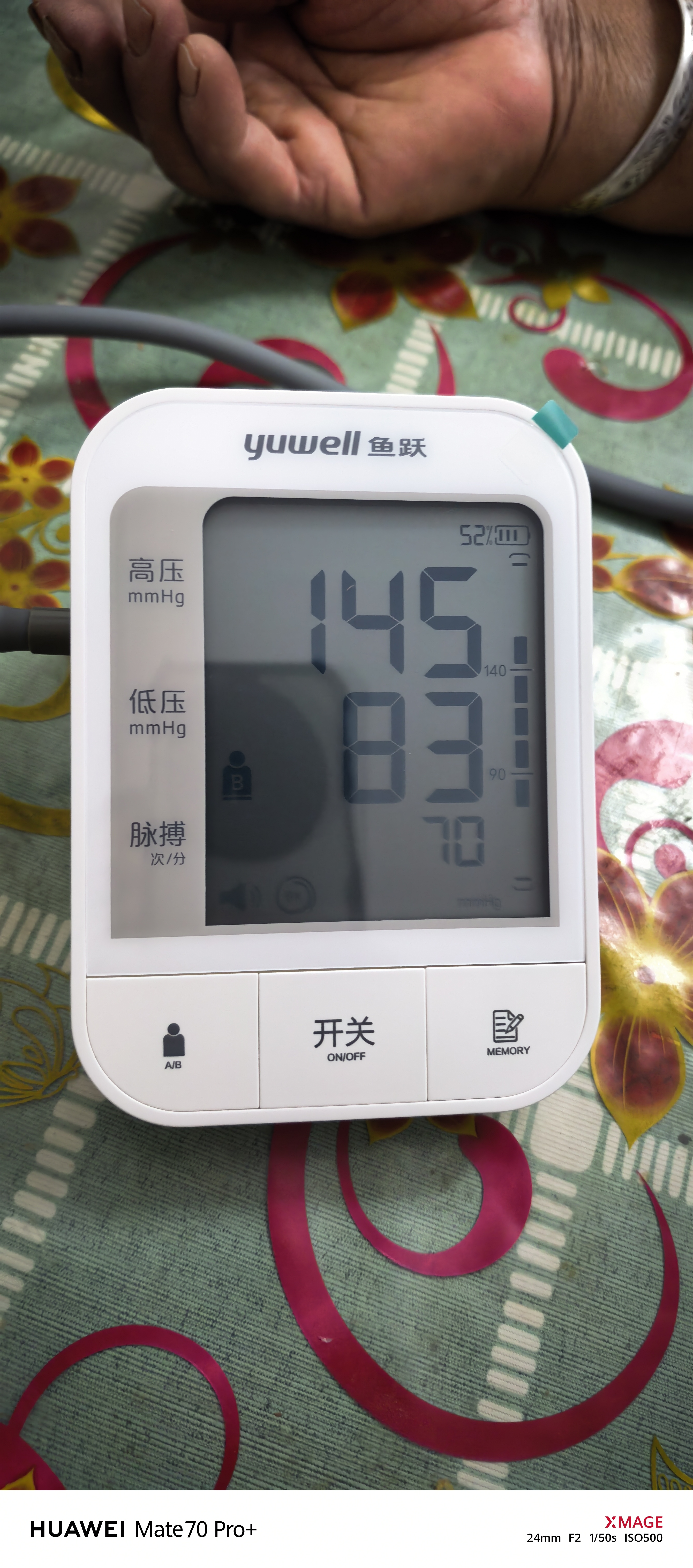 鱼跃（yuwell）上臂式电子血压计语音款血压仪医用高精准高血压测量仪家用670CR 实拍图