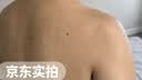 井次制药脂肪瘤专用去除神器脂肪康消除硬块脂肪粒去除皮脂腺囊肿非药膏 实拍图