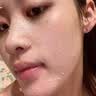 澳珀妮去角质啫喱面部去死皮去黑头粉刺控油深层清洁痘痘收缩毛孔男女士 实拍图