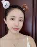 维特丝377面霜乳液男女士美白祛斑紧致高保湿补水去黄提亮黑色素护肤品 实拍图