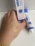 OHBT壬二酸15%凝胶祛痘药乳膏水杨酸霜青春痘学生祛痘印淡痘印坑消炎 实拍图