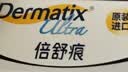 倍舒痕医用硅凝胶 增生疤痕剖腹产祛疤专用修复15g 实拍图