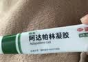 丽芙 阿达帕林凝胶0.1%*16g/盒 实拍图