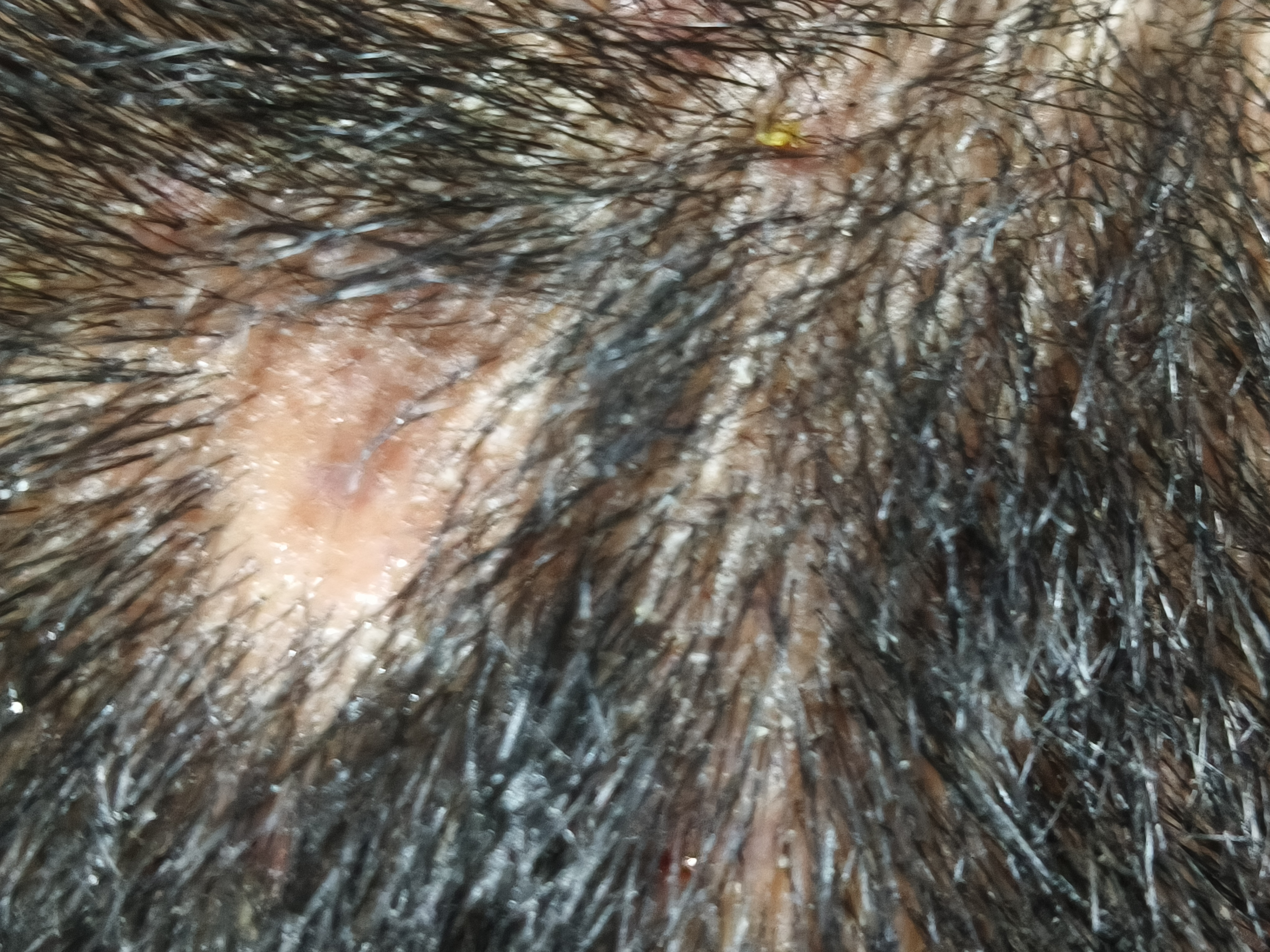 培健（Rogaine）落健米诺地尔泡沫剂5%男士专用  米诺地尔原研药单只美国进口60g单只 实拍图