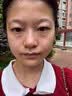 千绍方眼霜淡化细纹提拉紧致黑眼圈重度去除祛男女士熬夜黑色素专用的药 单盒装【快速去黑眼圈】 实拍图