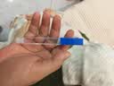 可孚玻璃体温计水银婴幼儿温度计人体医用高精度腋下体温表大1支 实拍图