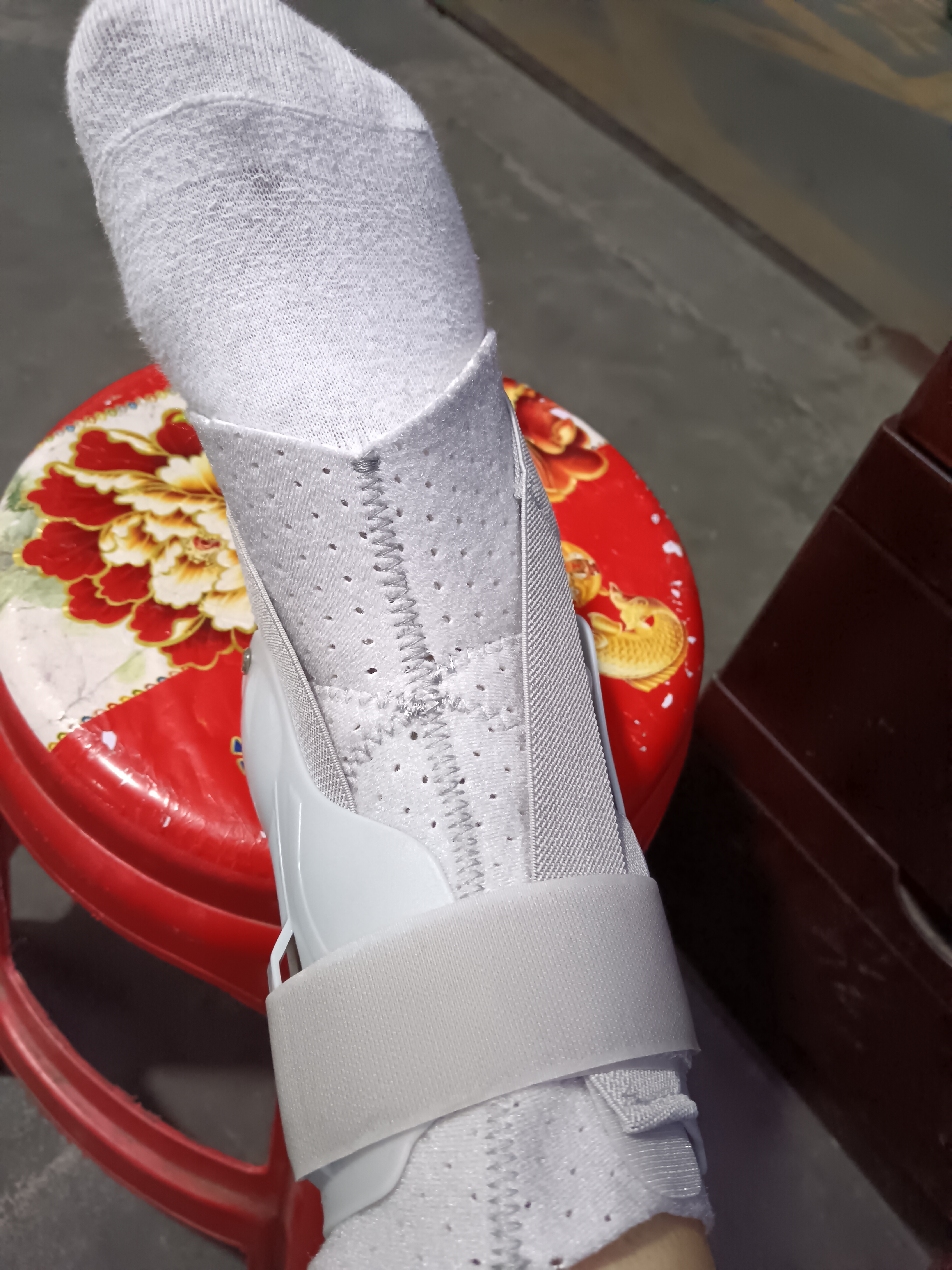 Olera护踝医用脚踝扭伤踝关节固定支具专业防崴脚骨折夹板康复硬护具XL 实拍图