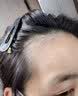 维特丝防脱洗发水生姜固发侧柏叶育控油去屑持久蓬松洗头膏露男女士专用 实拍图