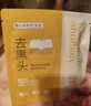 袋鼠妈妈青少年护肤套装 控油祛痘安肌旅行装（洁面15g+水15ml+乳10g） 实拍图