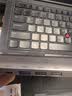 宏碁（acer）Typec/USB转网口扩展坞分线器HUB集线器 笔记本电脑网线转接头RJ45转换器台式机拓展坞 实拍图