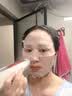 极萌负压水光仪【全能弹3月量】自打家用美容器院线美白抗衰祛黄提亮补水嫩肤生日礼物保价双11 实拍图