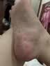 松尾制药日本脚气喷雾剂真菌感染脱皮止脚瘙痒臭烂脚丫汗水泡糜烂特效杀菌 实拍图