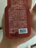 质润壬二酸15%凝胶祛痘印壬二酸乳膏水杨酸药膏去黑头祛痘闭口粉刺 实拍图