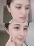 OHBT面膜美白淡斑补水保湿男女士熬夜舒缓抗皱紧致去黄气暗沉提亮肤色 实拍图