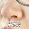 Losoki进口清洁泥膜深层清洁去黑头收缩毛孔粉刺闭口补水祛痘面膜150g 实拍图
