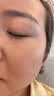 JOVS骄予时冰点美白淡斑超秒黑金光子嫩肤美容仪脸部美白提亮淡纹紧致女生生日情人节礼物 实拍图