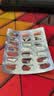 益美佳奥利司他胶囊60mg*21粒 减脂减重 减肥药 塑身排油瘦身 治疗肥胖 实拍图