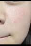 温博士去黑头水杨酸面膜清洁泥膜粉刺闭口收缩毛孔修复深层涂抹式 实拍图