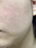 Newliann医用械字号喷雾补水保湿敏感肌晒后过敏修复皮肤屏障受损泛红急救 实拍图