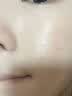 维特丝水杨酸祛痘精华淡化痘印去痘痘收毛孔男女护肤青春期学生专用30g 实拍图