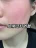 Newliann医用械字号面膜胶原蛋白冷敷贴医美术后修复保湿补水祛痘晒后修护 实拍图
