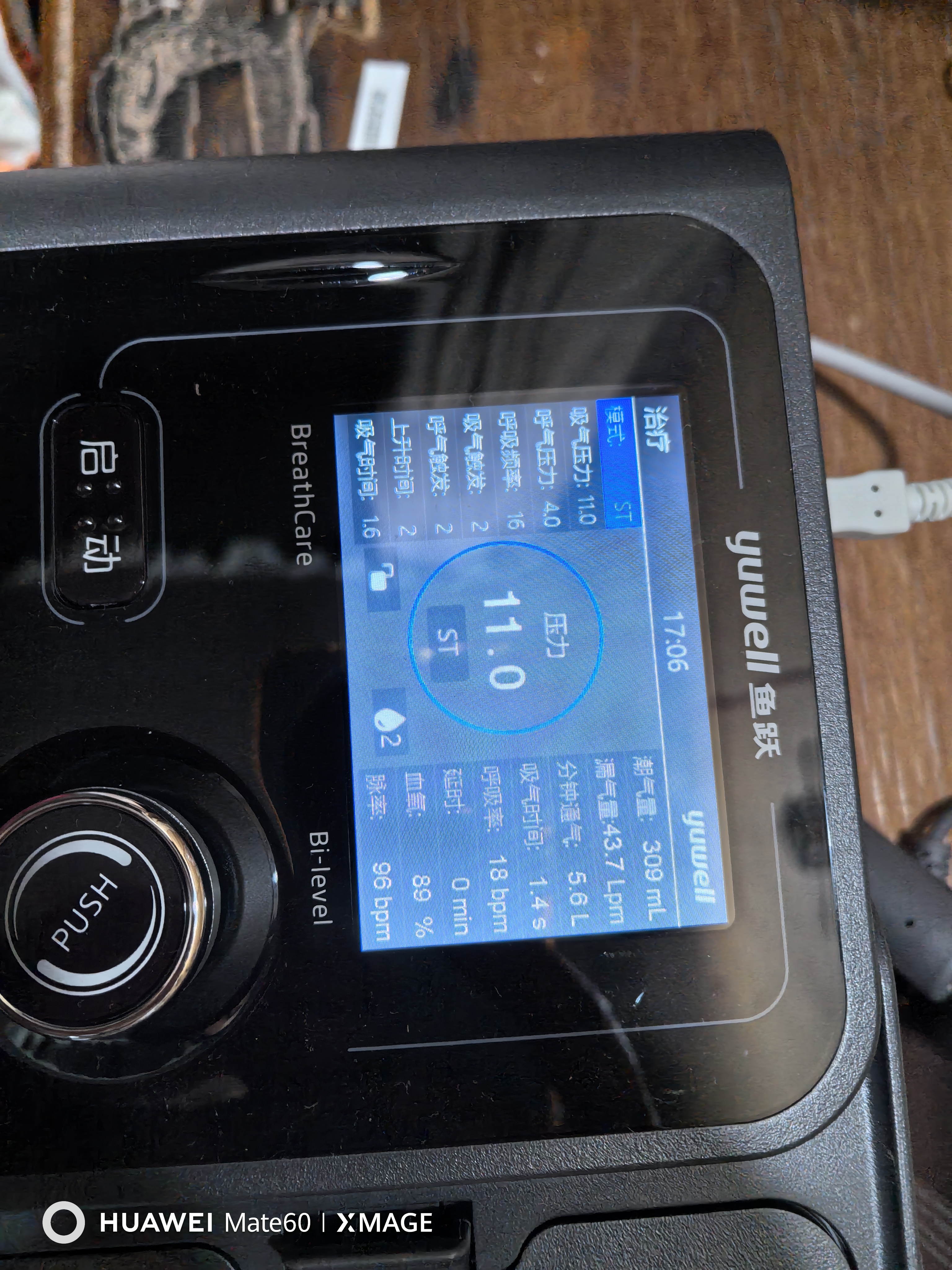 鱼跃YH-725ST双水平呼吸机全自动家医用老人慢阻肺排二氧化碳BIPAP 实拍图