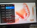 腾讯极光盒子6 8K智能网络电视机顶盒 4+64G高配 千兆网口 高清HDR10+ 双频WiFi 蓝牙语音遥控 实拍图